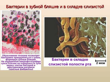 Microbiologie, Virologie și Imunologie a Boli Orale Odesa