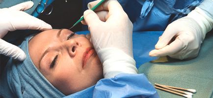 Pot procedurile cosmetice afectează rezultatul chirurgiei plastice - observații