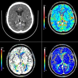 MRI под упойка ли възрастни и главата на детето и мозъка