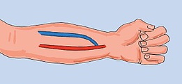 NEPHROCARE - a betegek