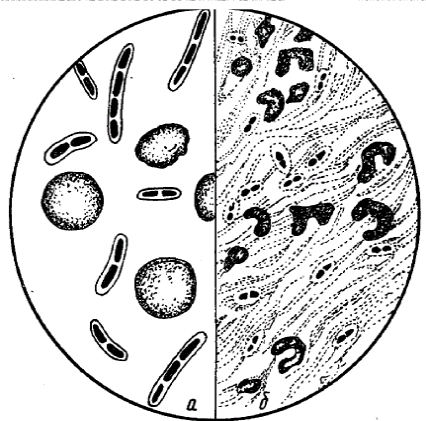 Colorarea microorganismelor rapide acide