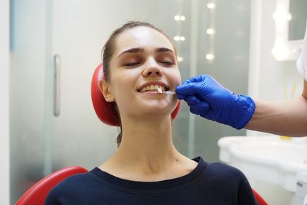 Відбілювання зубів за insmile кого вибрав лікар, beauty insider