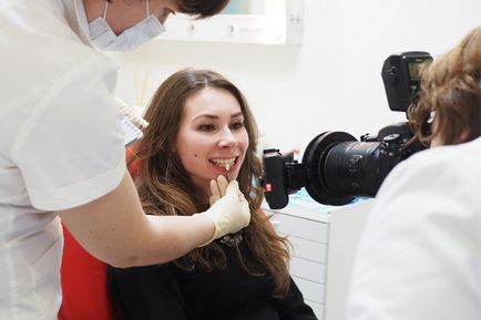 Відбілювання зубів за insmile кого вибрав лікар, beauty insider