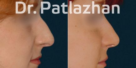 Chirurgie plastică la Kiev, Odessa, Dnipro, Clinica de Chirurgie Plastică Dr. Patlajan g