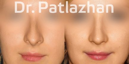 Chirurgie plastică la Kiev, Odessa, Dnipro, Clinica de Chirurgie Plastică Dr. Patlajan g