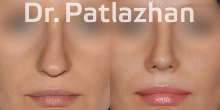 Chirurgie plastică la Kiev, Odessa, Dnipro, Clinica de Chirurgie Plastică Dr. Patlajan g