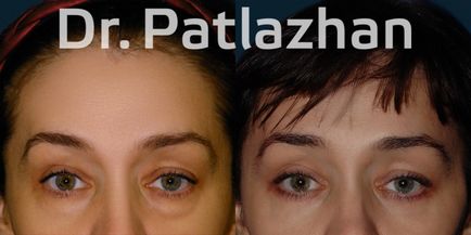 Пластична хірургія в киеве, одесі, дніпрі, клініка пластичної хірургії доктора Патлажана г