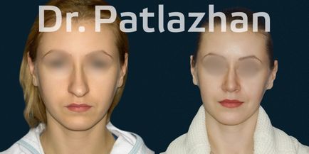 Chirurgie plastică la Kiev, Odessa, Dnipro, Clinica de Chirurgie Plastică Dr. Patlajan g