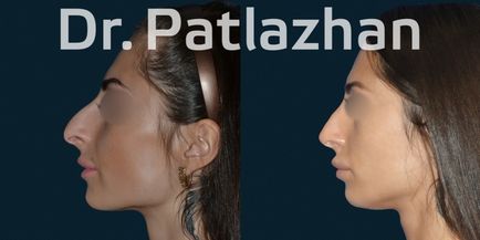 Chirurgie plastică la Kiev, Odessa, Dnipro, Clinica de Chirurgie Plastică Dr. Patlajan g