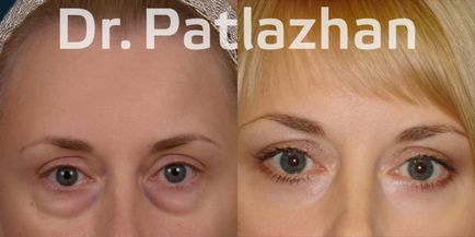 Chirurgie plastică la Kiev, Odessa, Dnipro, Clinica de Chirurgie Plastică Dr. Patlajan g