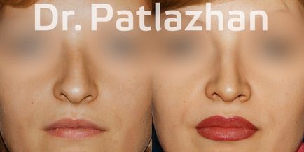 Chirurgie plastică la Kiev, Odessa, Dnipro, Clinica de Chirurgie Plastică Dr. Patlajan g