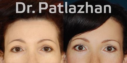 Plasztikai sebészet Kijevben, Odesszában, Dnyeper, plasztikai sebészet klinika Dr. Patlazhan g