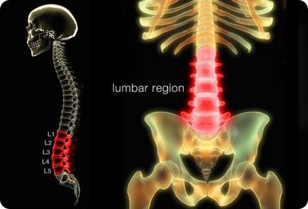 Radiculopatia lombosacrală