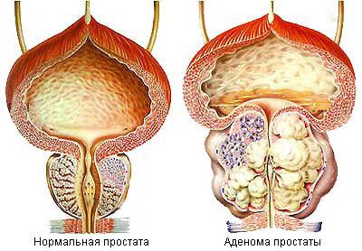 Medicamentul se concentrează (componente active ale medicamentului) Drogurile se concentrează