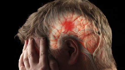 Semne de accident vascular cerebral la bărbați cu alcoolism și prim ajutor