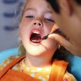 Megelőzés fogszuvasodás a maradandó fogak gyerek - kezelőorvosát Aibolit