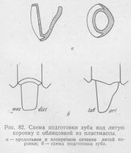 Proteze cu coroană combinată, stomatologie ortopedică