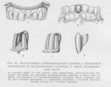 Proteze cu coroană combinată, stomatologie ortopedică