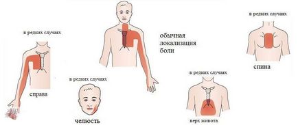 Стенокардія симптоми що треба робити і що не можна робити