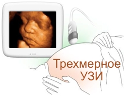 Uzi tridimensional (diferența față de aplicația bidimensională în obstetrică) - voevodin cu