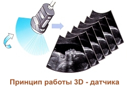 Uzi tridimensional (diferența față de aplicația bidimensională în obstetrică) - voevodin cu