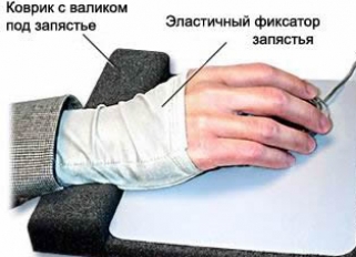 Sindromul încheieturii mâinii (sindromul carpian), simptome, tratament, funcționare