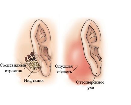 Cauzele urechii, simptomele și tratamentul dermatitei urechii