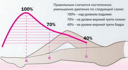 Варикоз лікування медикаментозне і за допомогою народної медицини