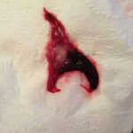 Descărcarea după instalarea spiralei intrauterine sângeroase, maro, sub formă de mucus