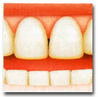 Proteză dentară