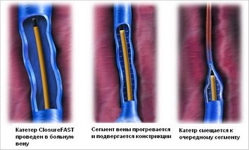 A 67-a catedră a Serviciilor Centrului Phlebologic din Moscova