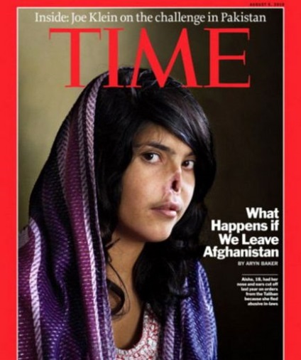 Afgán lány, akinek a férje levágta az orrát, tett egy új arc