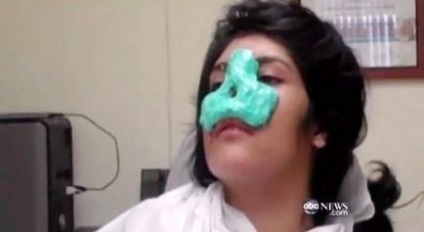 Afgán lány, akinek a férje levágta az orrát, tett egy új arc