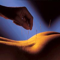 Acupunctura normalizează fundalul hormonal în ovarele polichistice