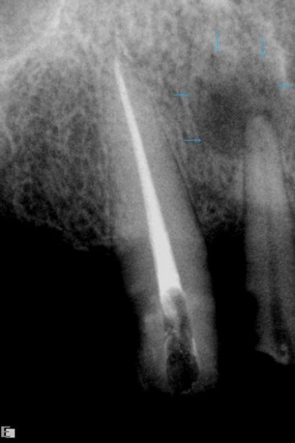 Structura anatomică a dintelui