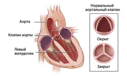 Supapă aortică