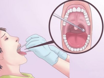 Înghițiți gâtul înghițit fără febră, tratamentul gâtului