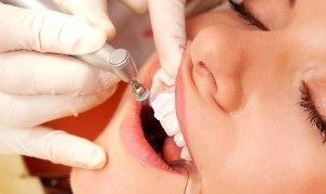 Dălchiul dinților, așa cum ar trebui curățat, este probabil cel mai bun loc pentru tratamentul stomatologic