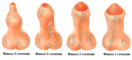 Membre de diferite forme și mărimi