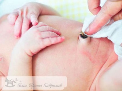 Що робити якщо кровит пупок у новонародженого 6 ефективних методів допомоги малюкові