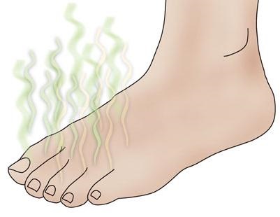 Ce să faceți dacă picioarele dumneavoastră transpiră și miroase
