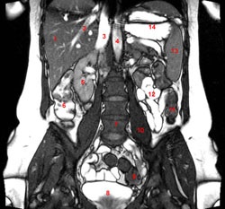 Ceea ce arată domnul cavității abdominale și coloanei vertebrale