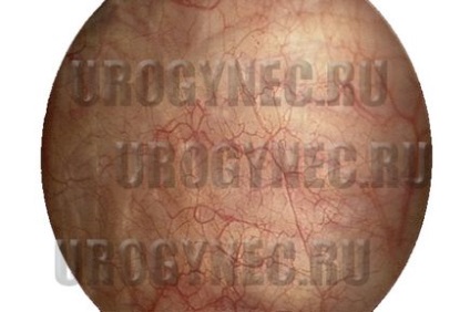 Cisztoszkópia, urogynecology Balashikha, vasúti, Reutov