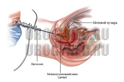 Cisztoszkópia, urogynecology Balashikha, vasúti, Reutov