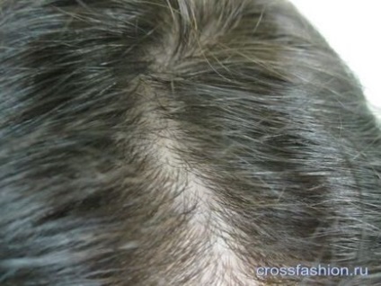Crossfashion csoport -, hogyan kell festeni a szürke haja predpigmentatsiya fokális szürke haja festett sötét színek