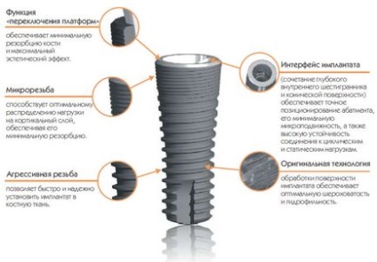 Implanturile dentare 