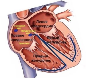 Екстрасистолія види, причини, діагностика, лікування, профілактика