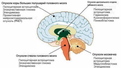 Gama cuțit și cuțit cibernetic ce este diferența