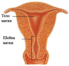 Hypoplasia extensiei uterine, simptome, cauze, tratament