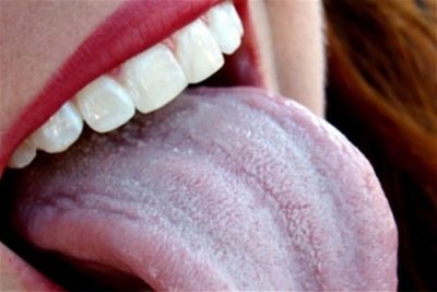 Гіркота в роті після їжі причини і лікування гіркого присмаку